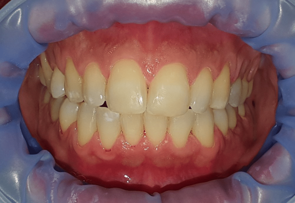 Lijepi i lijepo posloženi zubi